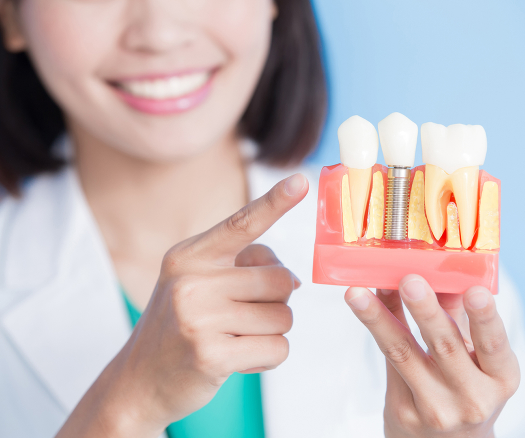 Dental Implant Procedure Hackensack, NJ
