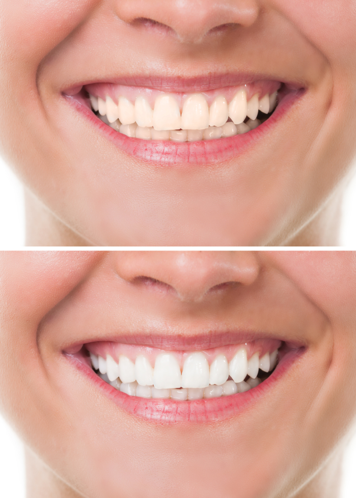 Cosmetic Dentistry Wayne, NJ Cosmetic Dentistry Wayne, NJ