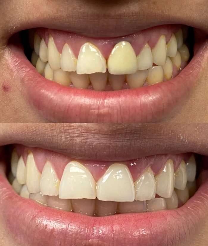Perfect Teeth Saddle Brook, NJ