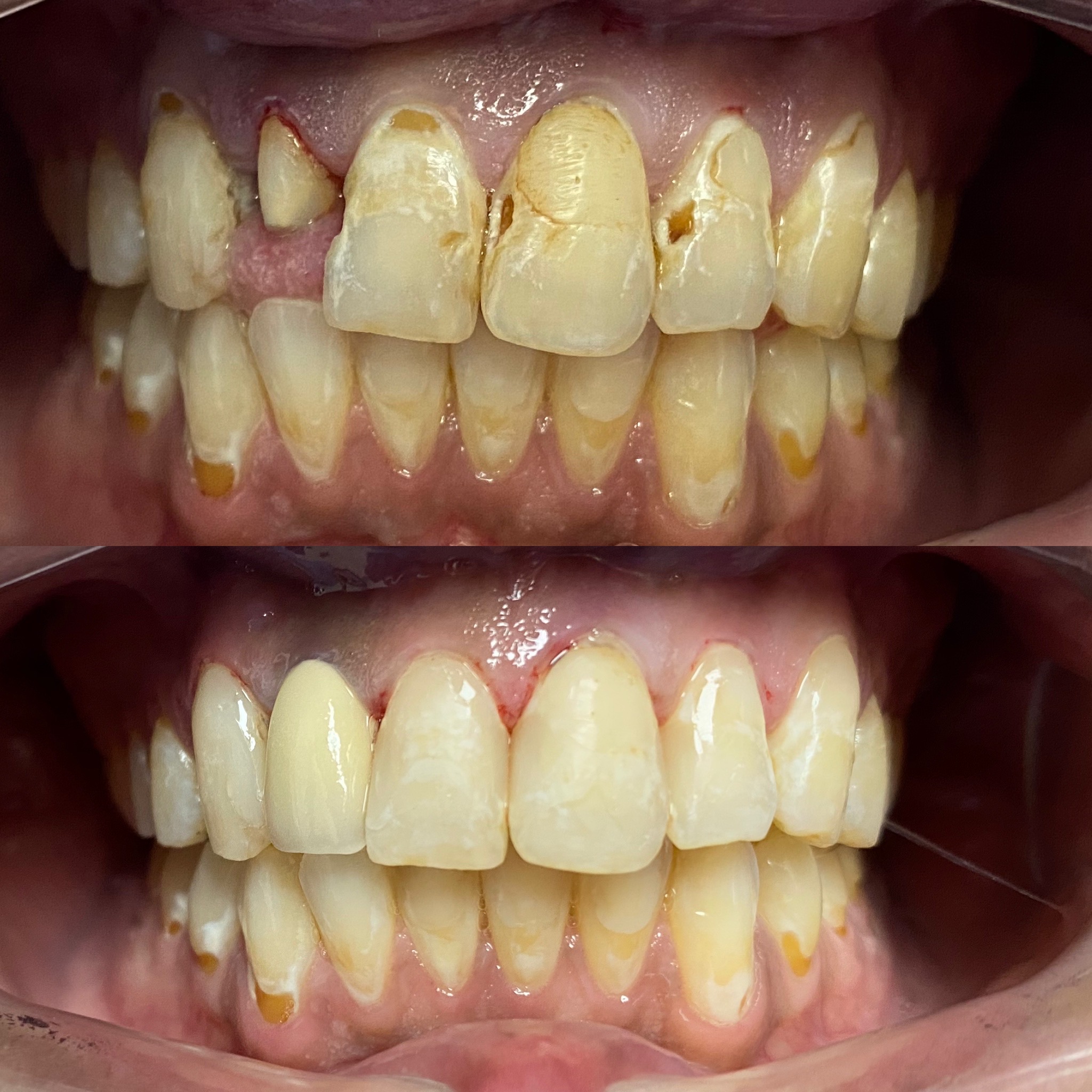 Dentistry Before and After Photos EverSmile Dental