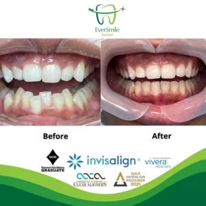 EverSmile Dental | Sedation Dentistry, Dental Cleanings and Oral Exams
