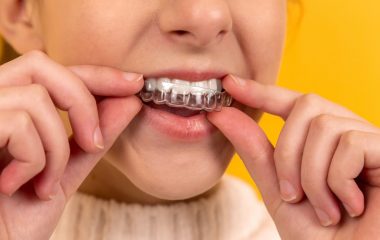 ORTHODONTIC TREATMENT