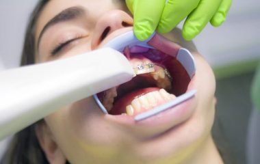 RETAINER WEAR &AMP; CARE
