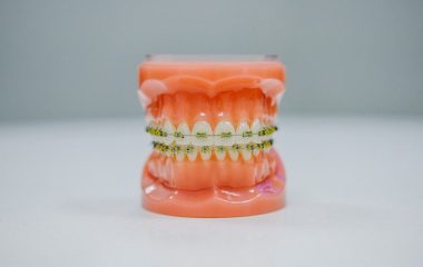 DENTAL INVISALIGN IN SADDLE BROOK